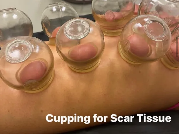 Susan massage therapist 