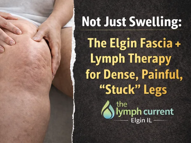 The Lymph Current