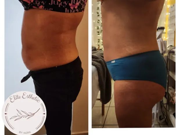 Elite Esthetic by Nora