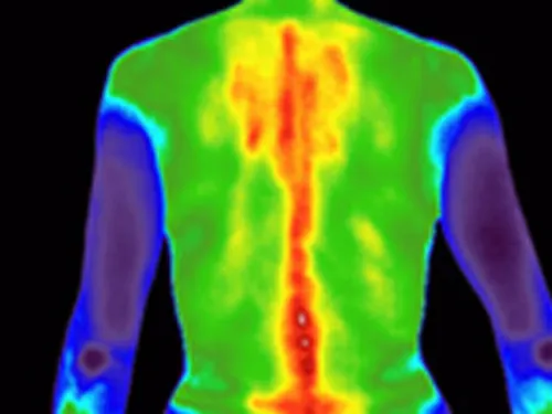 Thermography B.